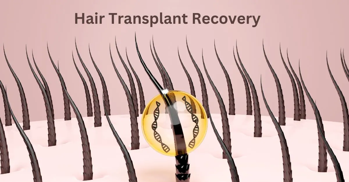 Hair Transplant Recovery