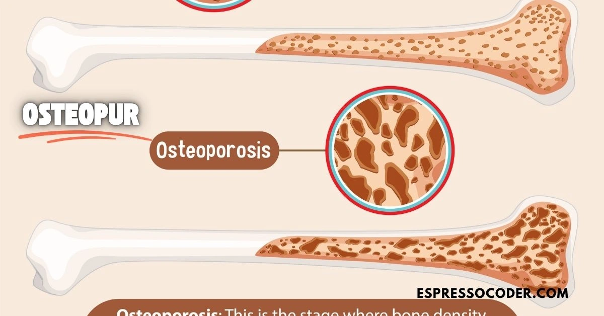 Comparison of bone density before and after taking OsteoPur supplement for 6 months.